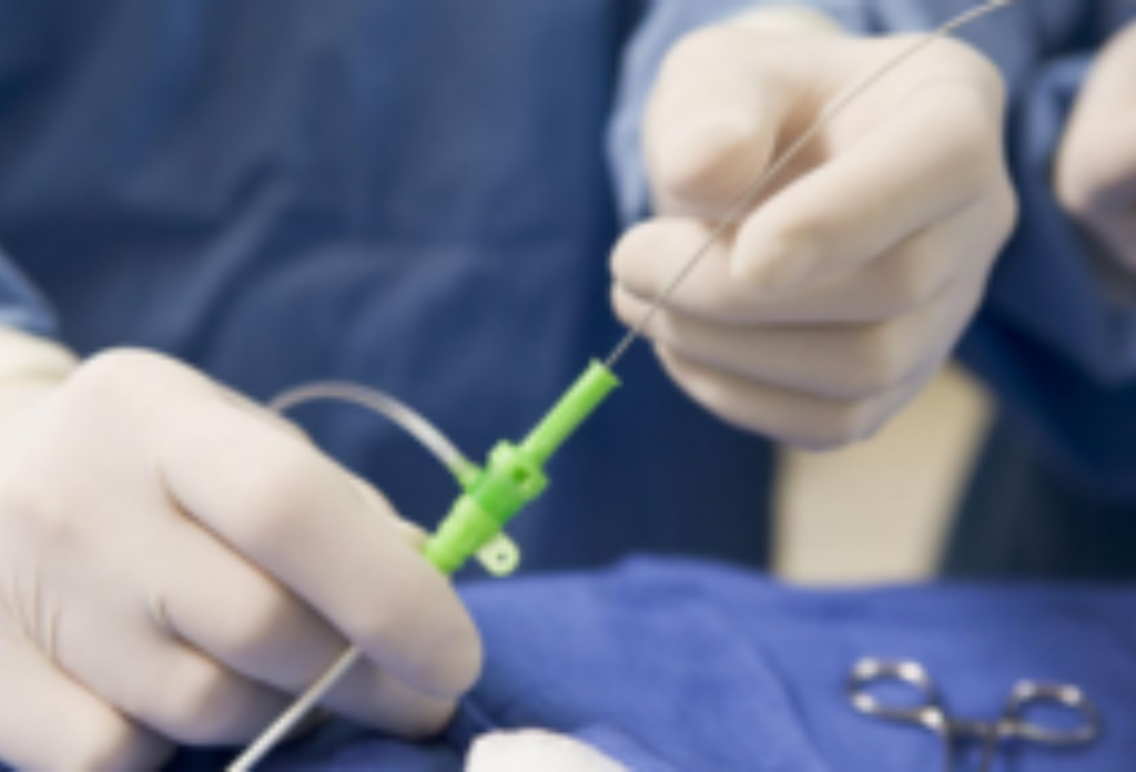 Closing the Loop Between In-Process and Offline Measurements of Flexible Medical Tubing Products for Compliance Validation Closing the Loop Between In-Process and Offline Measurements of Flexible Medical Tubing Products for Compliance Validation