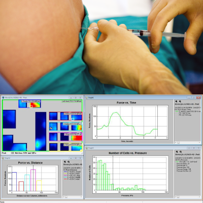 Tekscan GripApplication_MedicalDevice_MarqueePhoto (1) Tekscan GripApplication_MedicalDevice_MarqueePhoto (1)